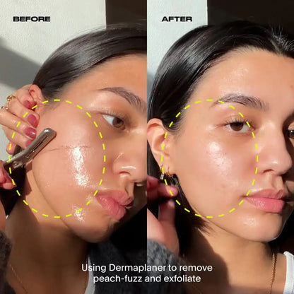 Dermaplaner Kit, Gold